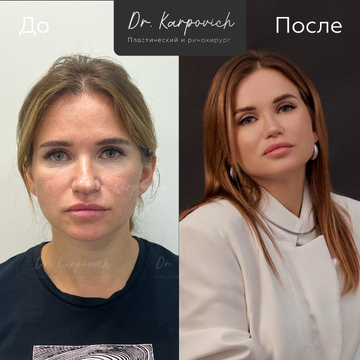 До и после. . Доктор Сергей Карпович