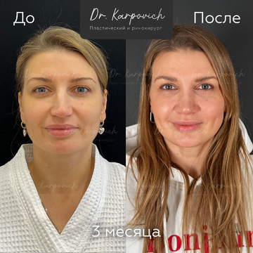 До и после. . Доктор Сергей Карпович