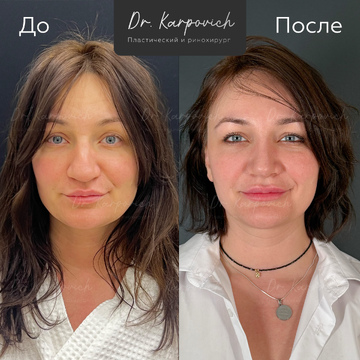 До и после. . Доктор Сергей Карпович