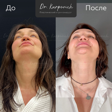 До и после. . Доктор Сергей Карпович