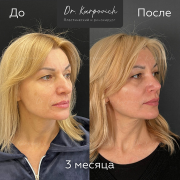 До и после. . Доктор Сергей Карпович