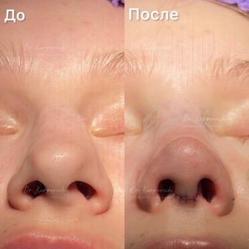 До и после. . Доктор Сергей Карпович