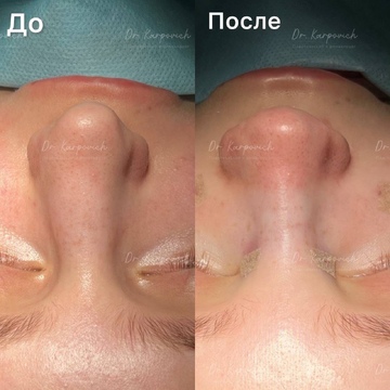 До и после. . Доктор Сергей Карпович