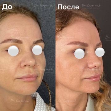 До и после. . Доктор Сергей Карпович