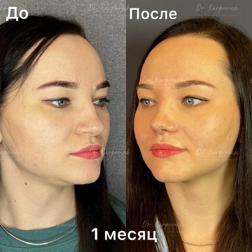 До и после. . Доктор Сергей Карпович