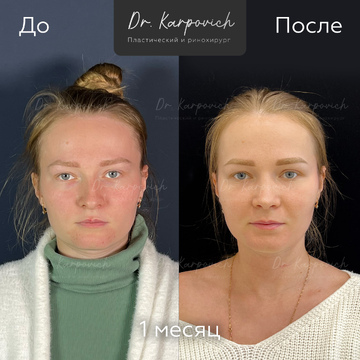 До и после. . Доктор Сергей Карпович