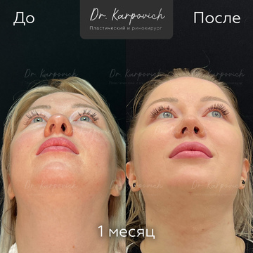 До и после. . Доктор Сергей Карпович