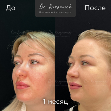 До и после. . Доктор Сергей Карпович