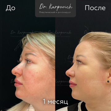 До и после. . Доктор Сергей Карпович
