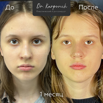 До и после. . Доктор Сергей Карпович