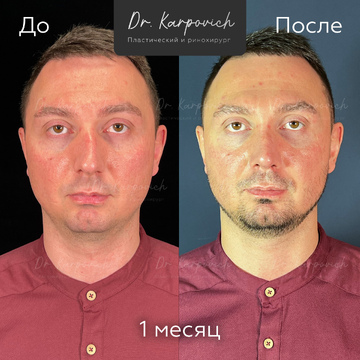 До и после. . Доктор Сергей Карпович