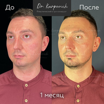 До и после. . Доктор Сергей Карпович