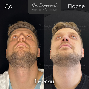 До и после. . Доктор Сергей Карпович
