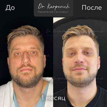 До и после. . Доктор Сергей Карпович