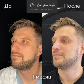 До и после. . Доктор Сергей Карпович