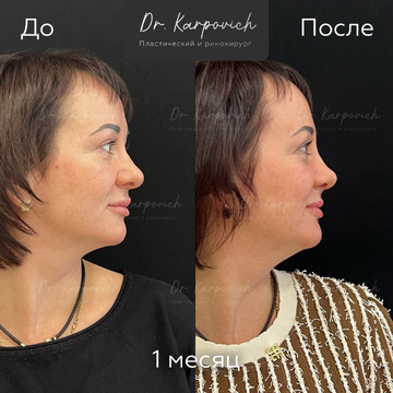 До и после. . Доктор Сергей Карпович