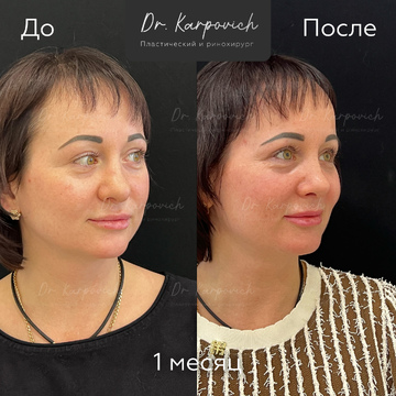 До и после. . Доктор Сергей Карпович