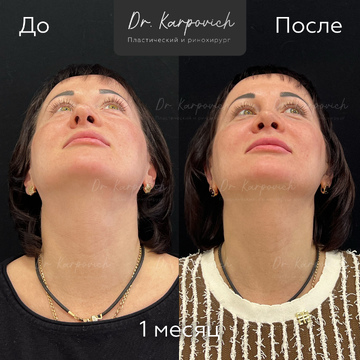 До и после. . Доктор Сергей Карпович