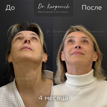 До и после. . Доктор Сергей Карпович
