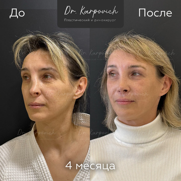 До и после. . Доктор Сергей Карпович