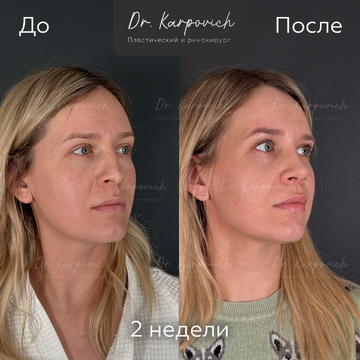 До и после. . Доктор Сергей Карпович