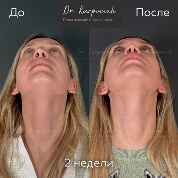 До и после. . Доктор Сергей Карпович