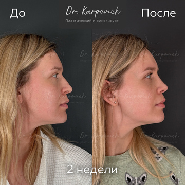 До и после. . Доктор Сергей Карпович