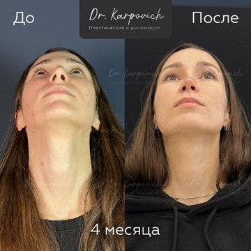 До и после. . Доктор Сергей Карпович