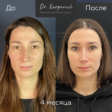 До и после. . Доктор Сергей Карпович