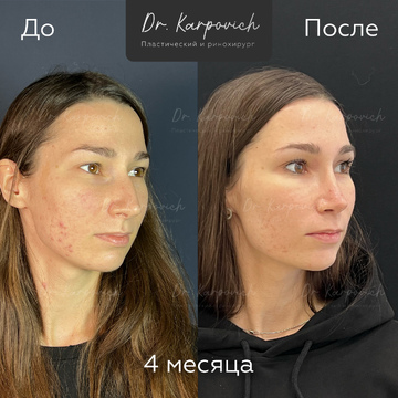 До и после. . Доктор Сергей Карпович
