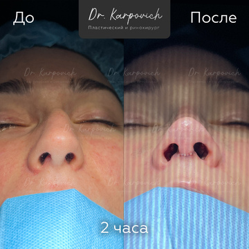 До и после. . Доктор Сергей Карпович
