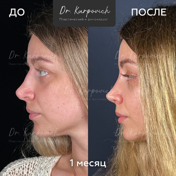 До и после. . Доктор Сергей Карпович