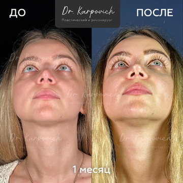 До и после. . Доктор Сергей Карпович