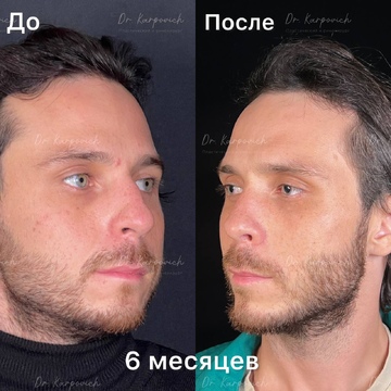 До и после. . Доктор Сергей Карпович