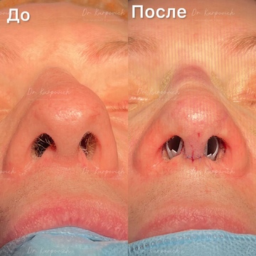 До и после. . Доктор Сергей Карпович