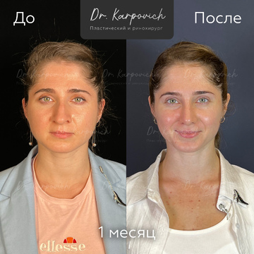 До и после. . Доктор Сергей Карпович