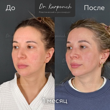 До и после. . Доктор Сергей Карпович