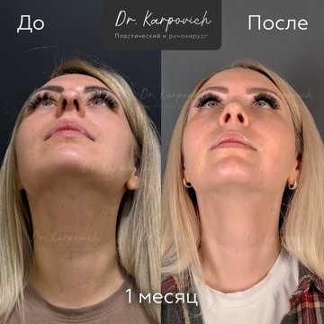 До и после. . Доктор Сергей Карпович