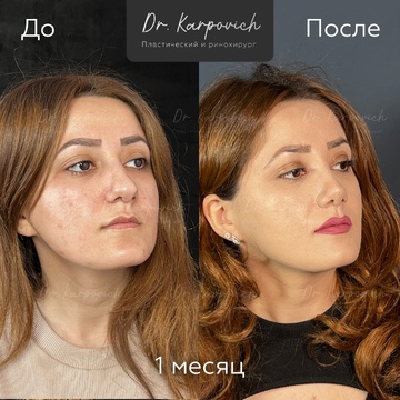 До и после. . Доктор Сергей Карпович