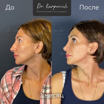 До и после. . Доктор Сергей Карпович