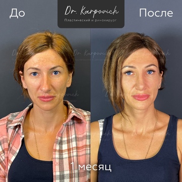 До и после. . Доктор Сергей Карпович