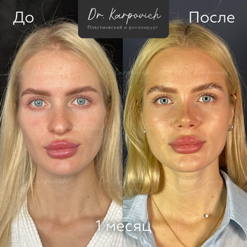 До и после. . Доктор Сергей Карпович