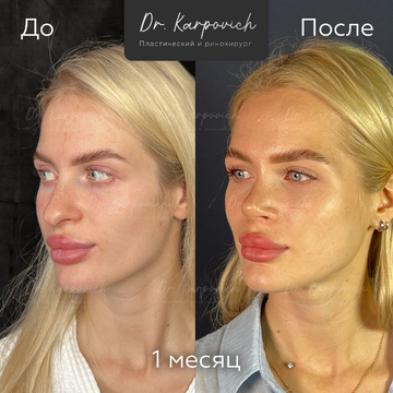 До и после. . Доктор Сергей Карпович