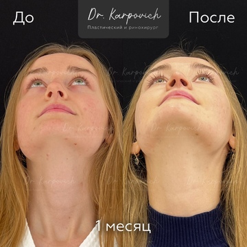 До и после. . Доктор Сергей Карпович