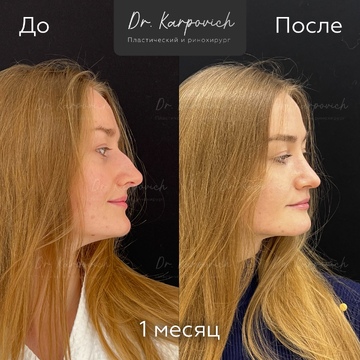 До и после. . Доктор Сергей Карпович