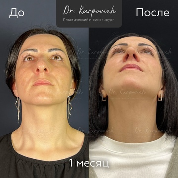 До и после. . Доктор Сергей Карпович