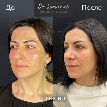 До и после. . Доктор Сергей Карпович