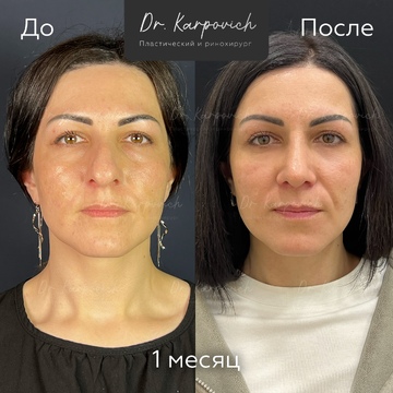 До и после. . Доктор Сергей Карпович