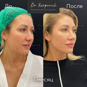 До и после. . Доктор Сергей Карпович