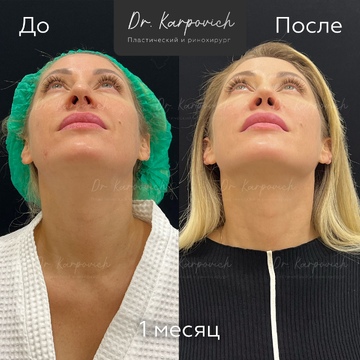 До и после. . Доктор Сергей Карпович